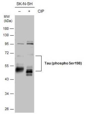 Western Blot: Tau [p Ser198] Antibody [NBP3-12927]